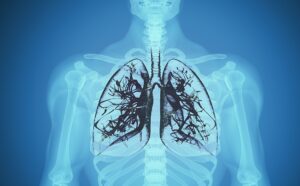 Kaynakçı Akciğer Hastalıkları