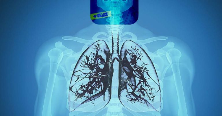 The Most Common Welder Diseases and Their Symptoms